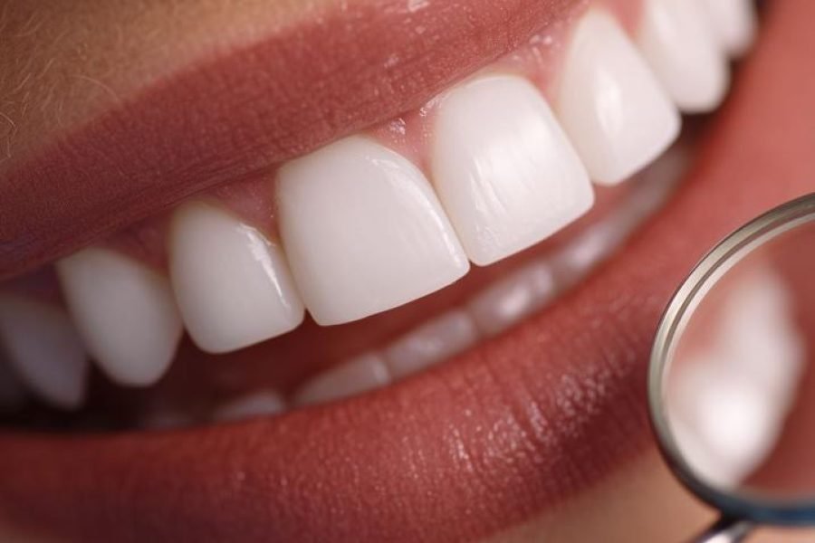 Holywood Smile Cairo-Alex-Giza package